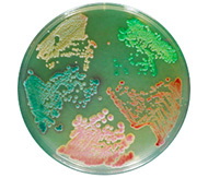 Каталог Для выделения, определения и подсчета патогенных микроорганизмов
